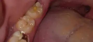 TLC Dental Care