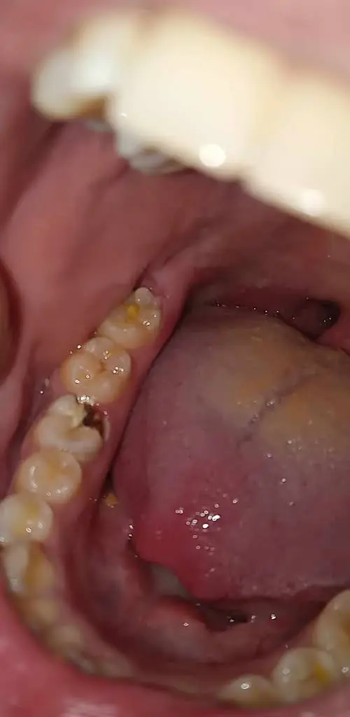 TLC Dental Care