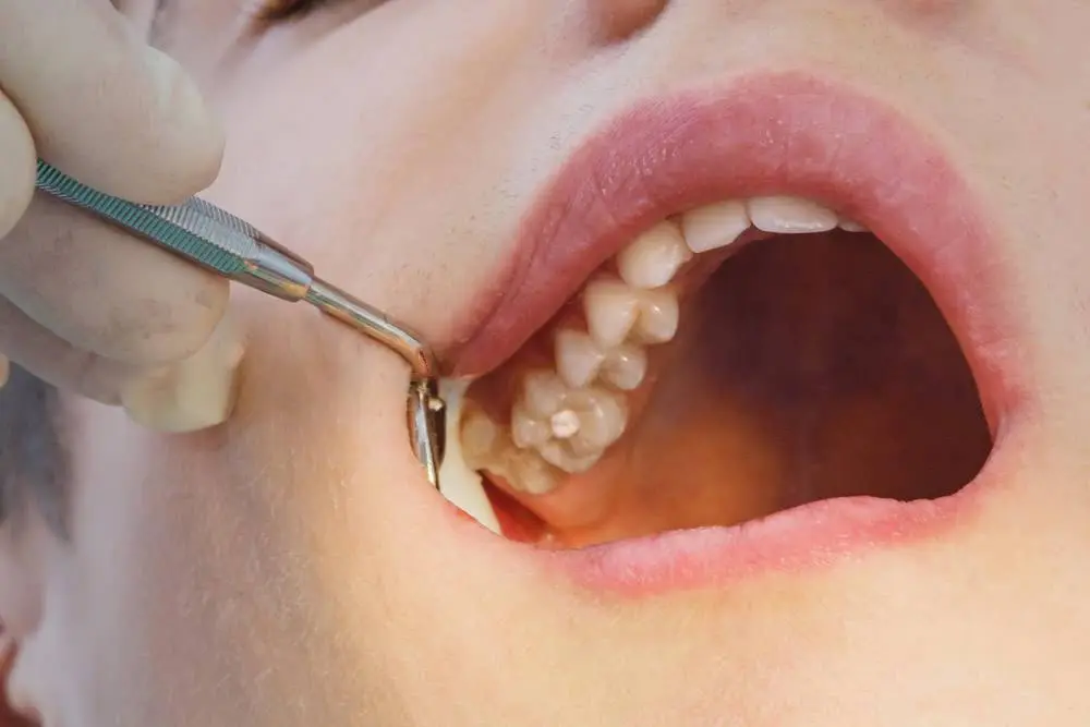 Grafton Family Dentistry, Christa J. Garcia, DDS PLLC
