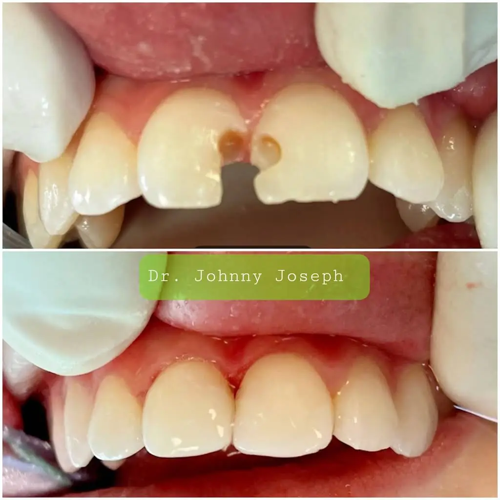 Pediatric Dentistry Asleep - East Ohio