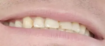 Dr. Phillip W. Wallace, DDS