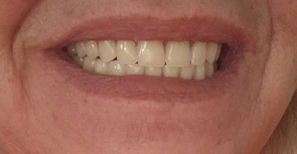 MidAmerica Center For Dental Wellness & Aesthetics, P.C.