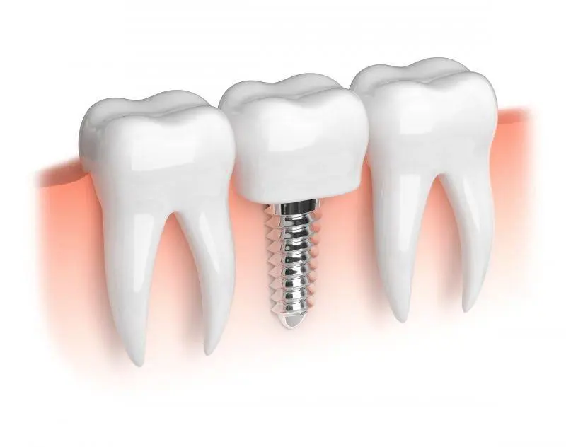 SmilesRForever Dentistry
