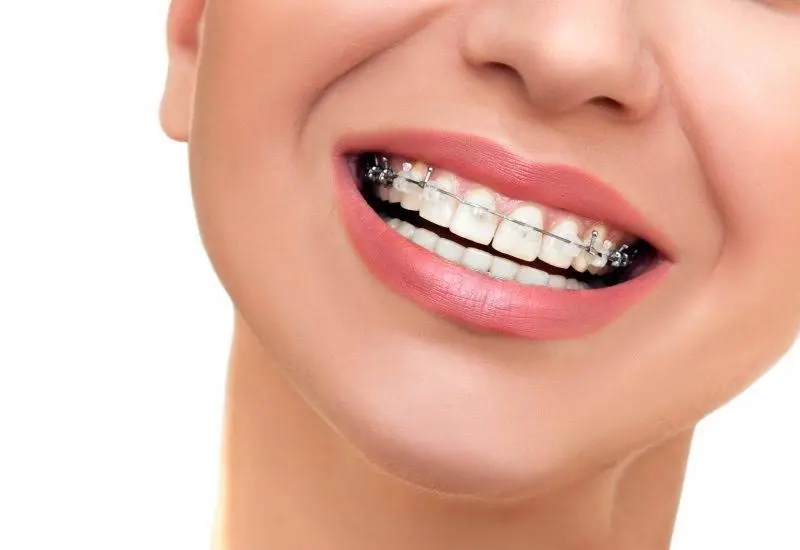 SmilesRForever Dentistry