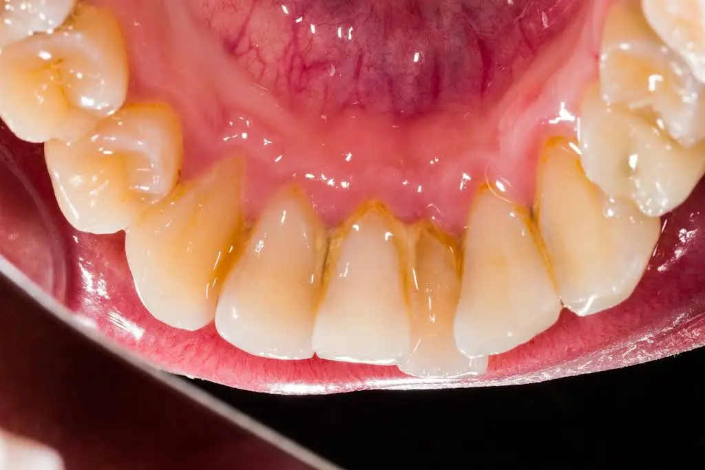 Kingston Dental Care