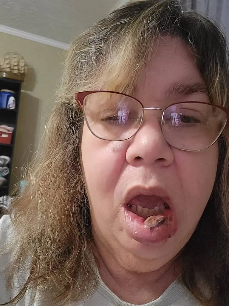 Aspen Dental