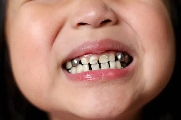 Simpson Dental PLLC