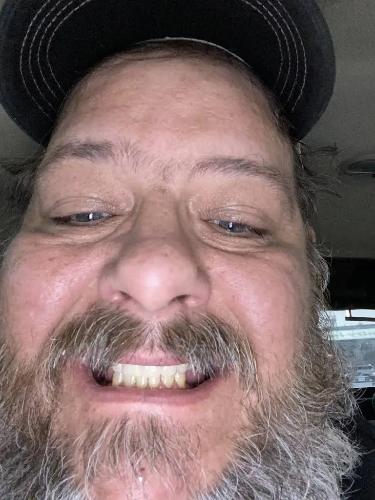 Affordable Dentures & Implants