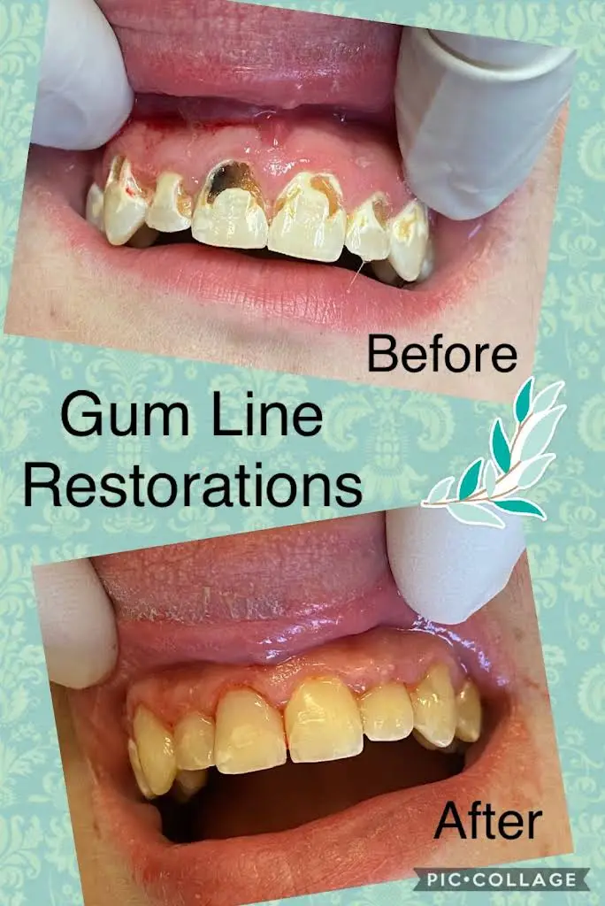 Lakeland Hills Dental: Walter J Jankowski DMD
