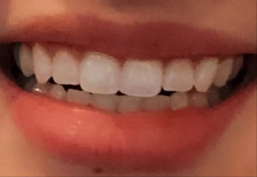 Park Place Dental Group - Shiloh