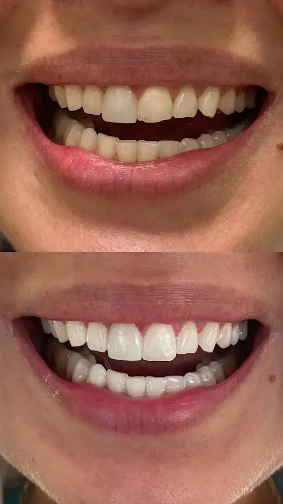 Aspen Dental