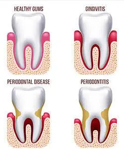 Henritze Dental Group - Stephen D. McCuin DDS - Radford