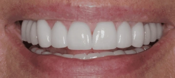 Gentle Dental