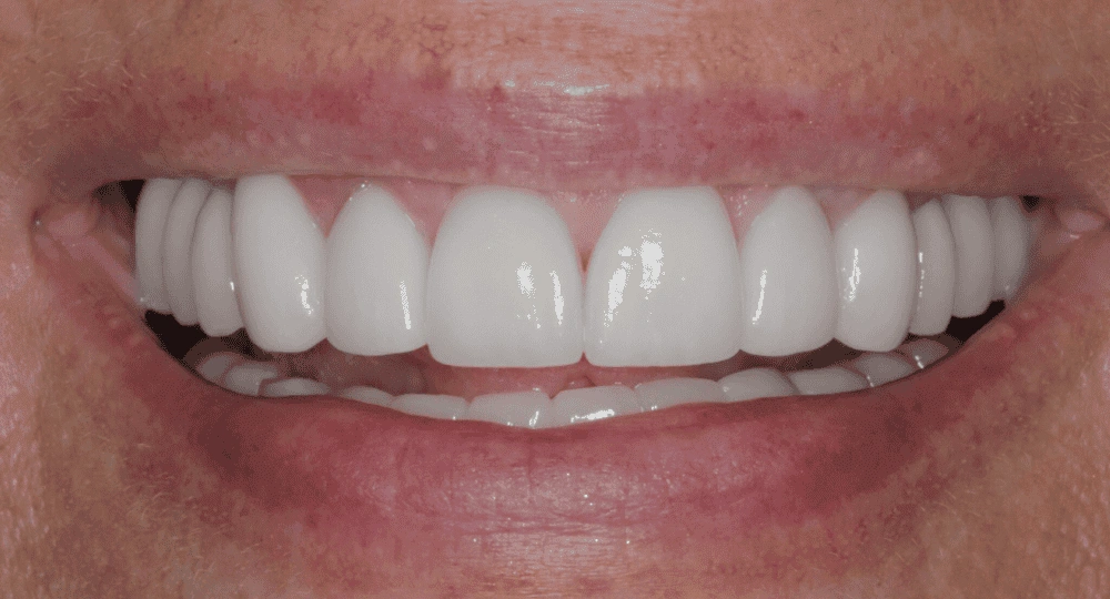 Gentle Dental