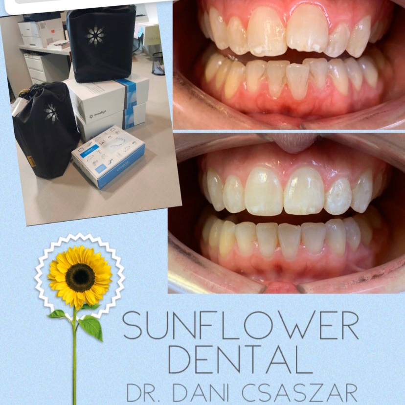 Sunflower Dental