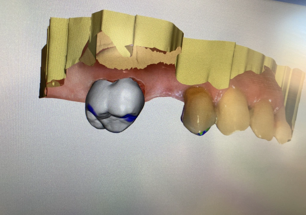 Bright Smiles Dentistry