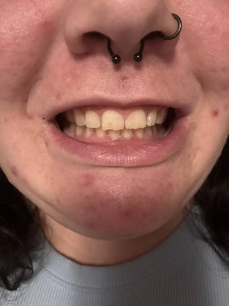 Smile For Life Dental Care
