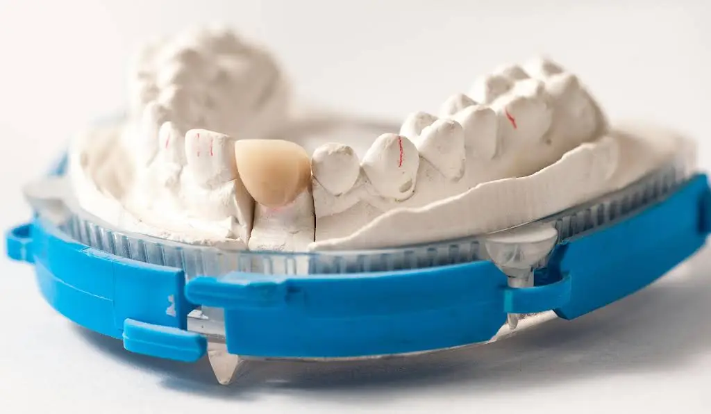 Meramec Family Dentistry
