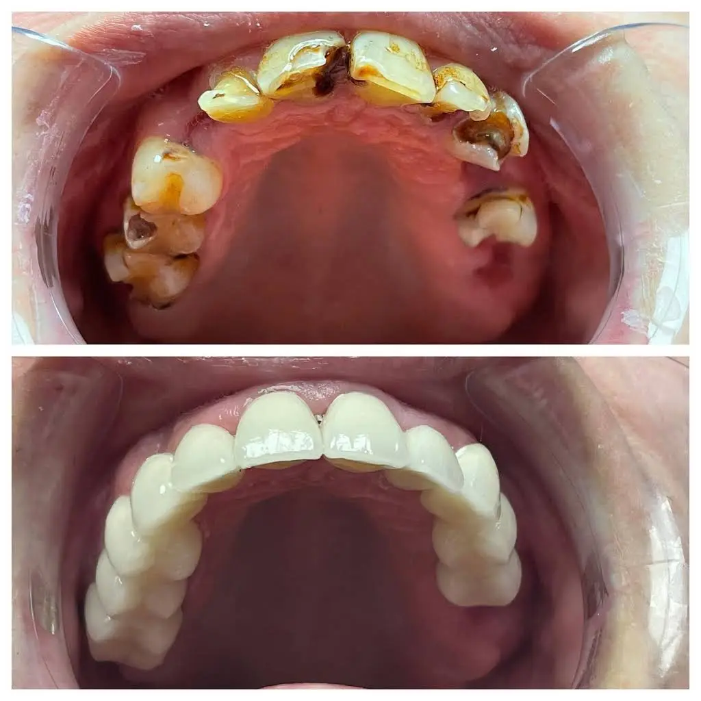 Hoke Family Dentistry, PLLC