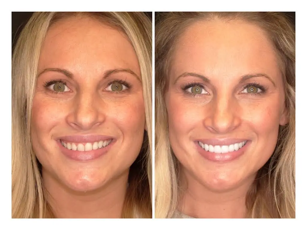 St. Louis County Dental Partnership - Grayem & Associates