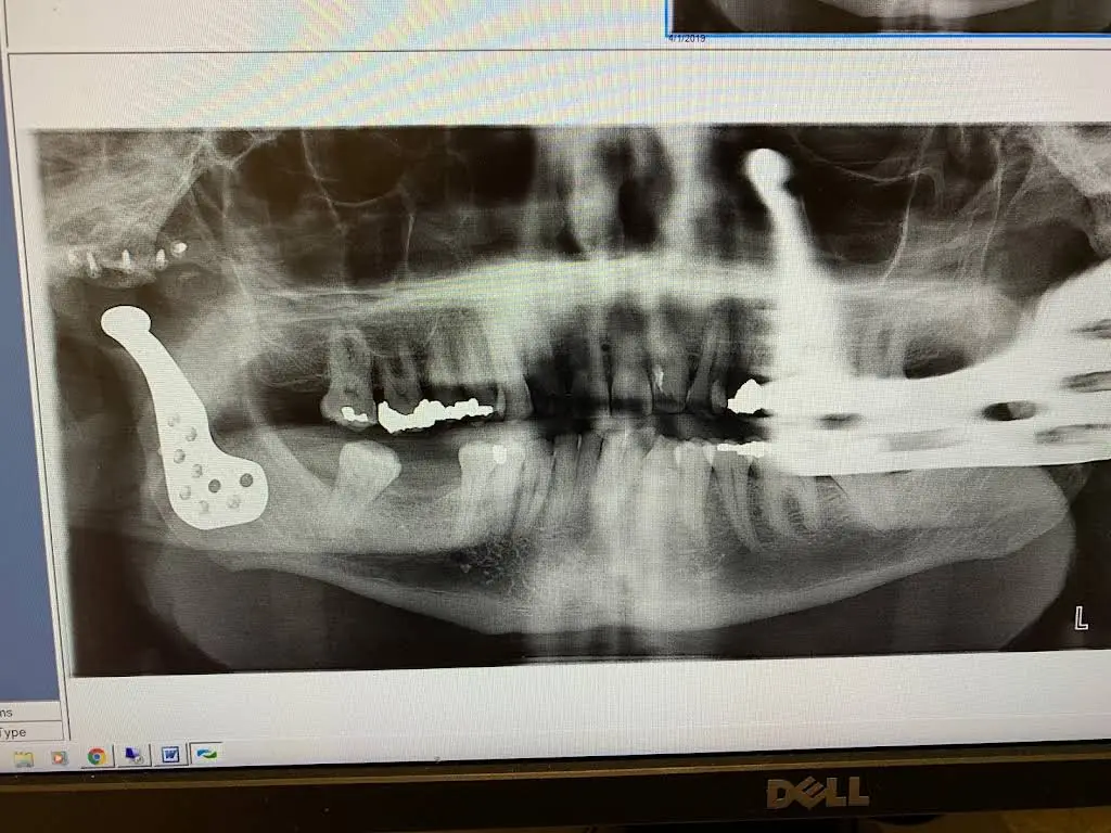 Southwest Oral Surgery