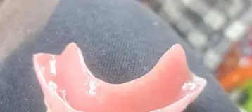 Affordable Dentures & Implants