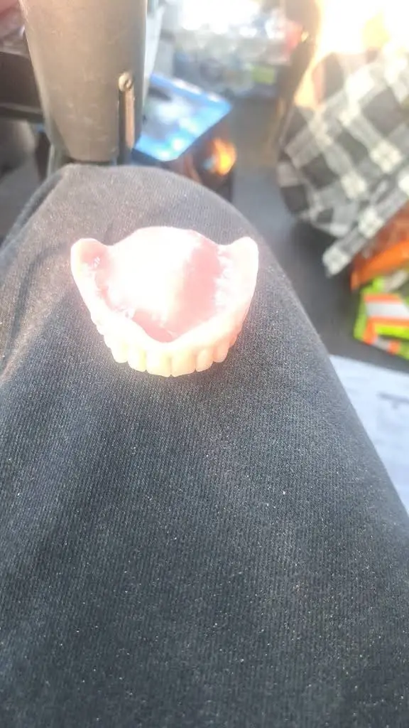 Affordable Dentures & Implants
