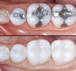 5 Stars Dental Jacob H. Pham DDS