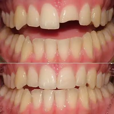 5 Stars Dental Jacob H. Pham DDS