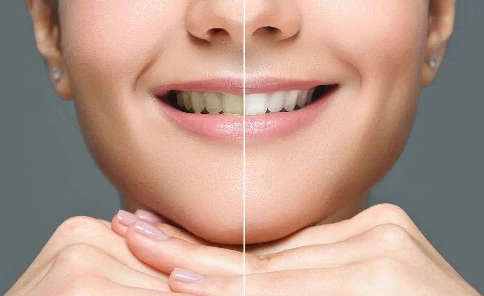 Cresaptown Dental LLC