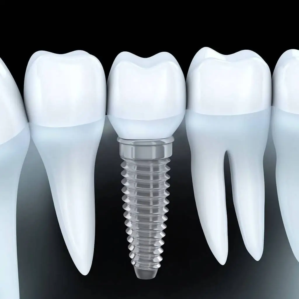 The Dental Center Gravois Bluffs