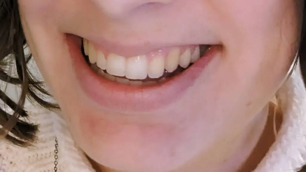 Best Care Dental - Dr. Maryana Kirolos