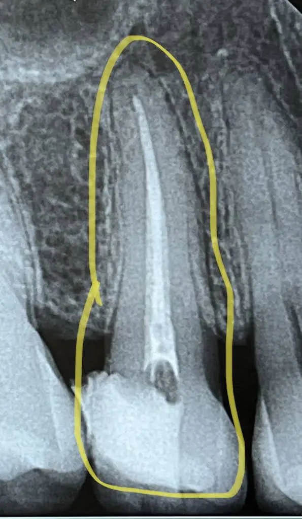 Fountain City Endodontics