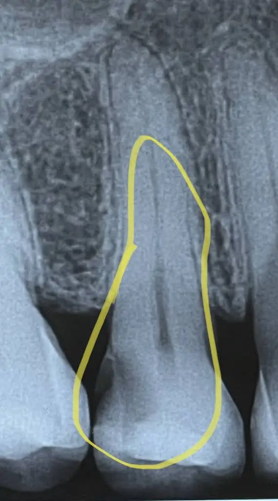 Fountain City Endodontics