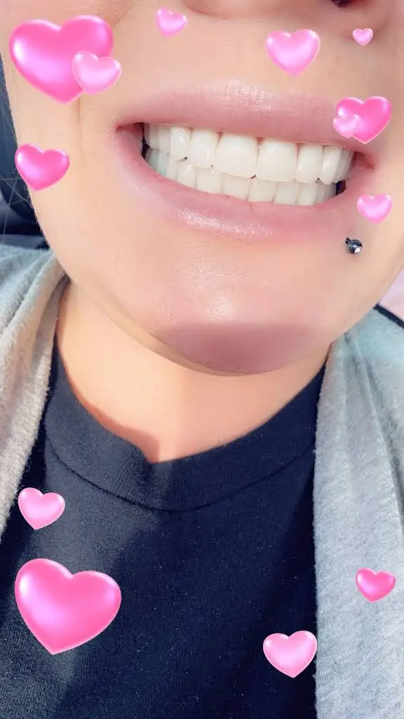 Affordable Dentures & Implants