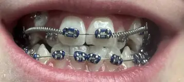 Brickman Orthodontics