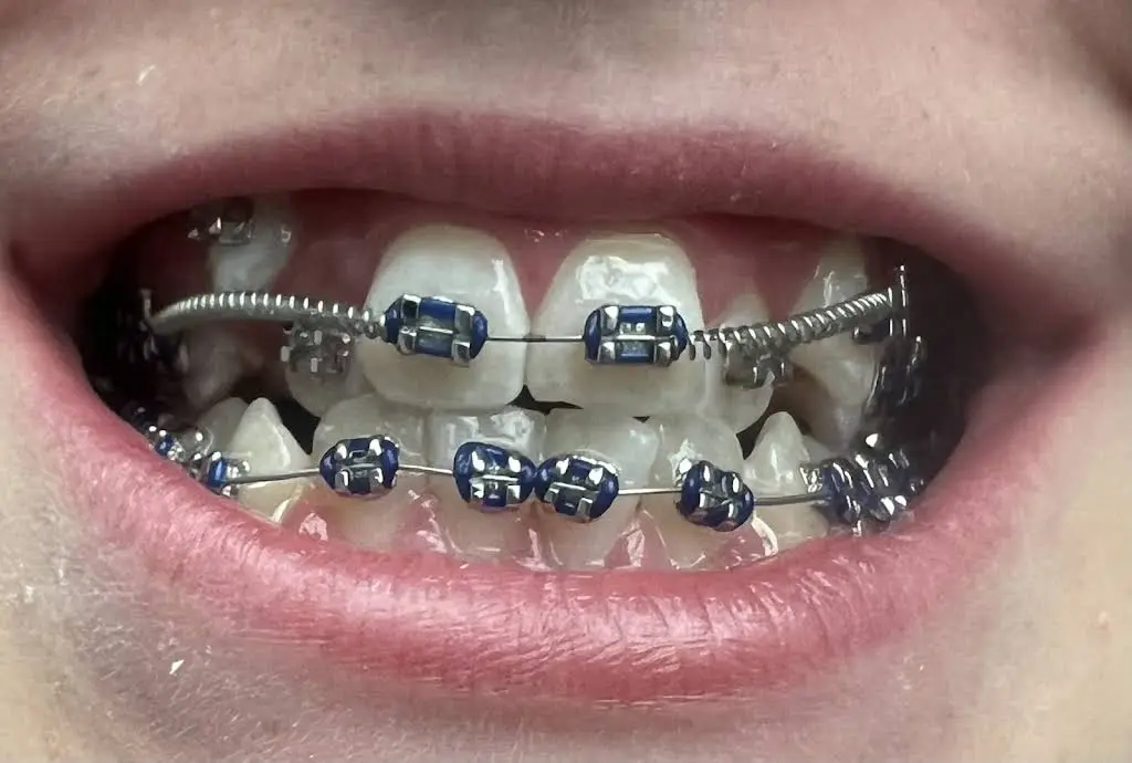 Brickman Orthodontics