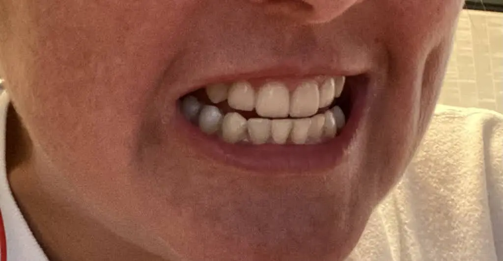 Boain Dental Care