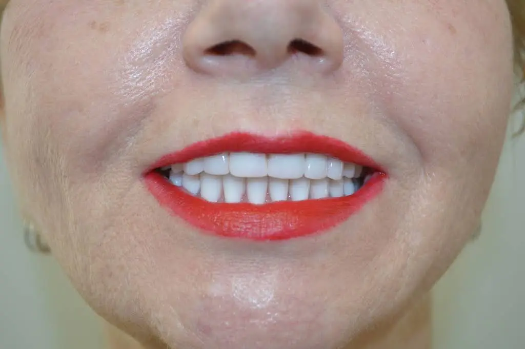 St. Louis Center for Aesthetic & Restorative Dentistry