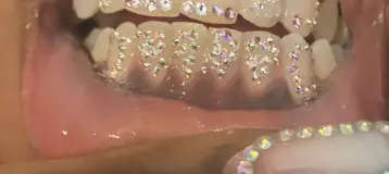 Glam Smiles St Louis