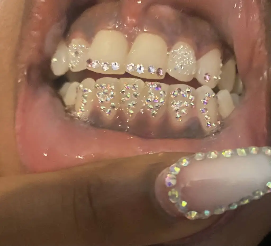 Glam Smiles St Louis - Professional dental clinic exterior with modern facilities