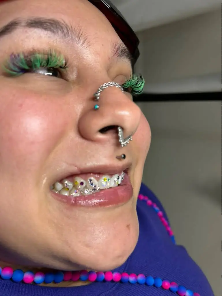 Glam Smiles St Louis