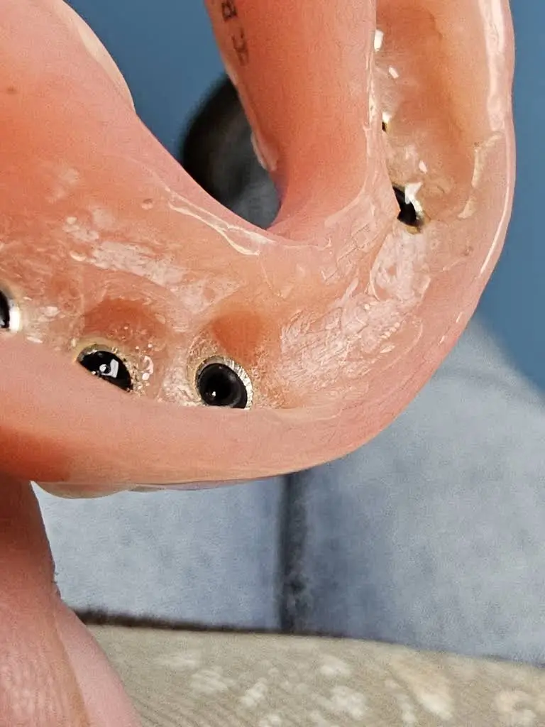 Affordable Dentures & Implants