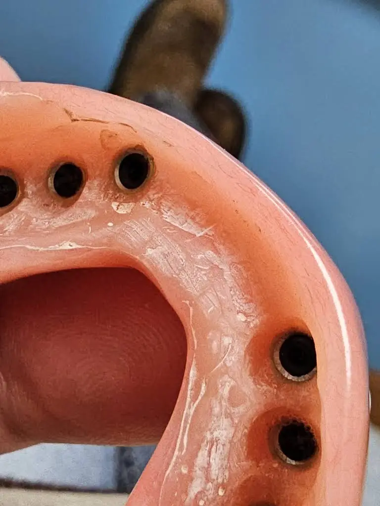 Affordable Dentures & Implants