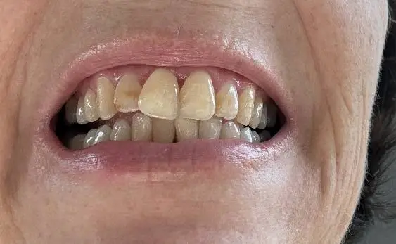 Cape Girardeau Dental Care