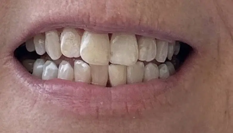 Cape Girardeau Dental Care
