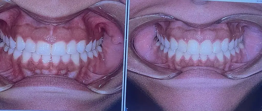 Schlueter Periodontics & Implants