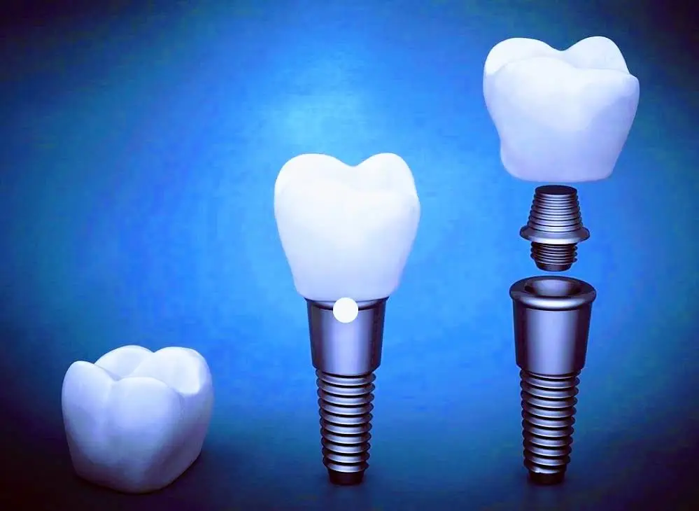 Blue Ridge Oral & Maxillofacial Surgery