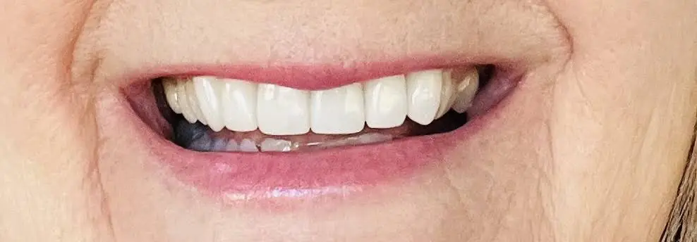 Cross, Lavinder, Quinn & Park Family Dentistry - Roanoke