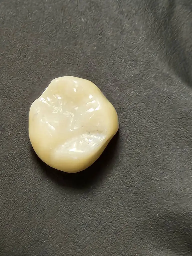 Appalachian Dental Care